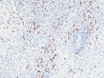 IL-6Rα rabbit pAb