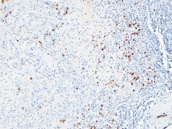 IL6Ralpha antibody