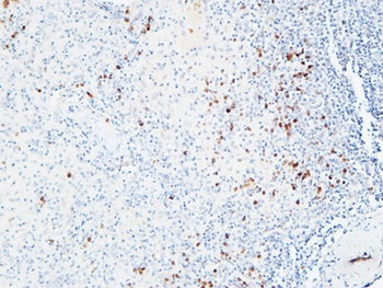 IL-6Rα rabbit pAb