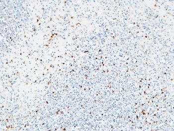 IL-6Rα rabbit pAb