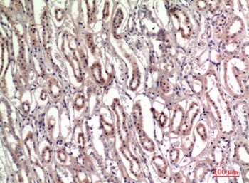 Tenascin-C antibody