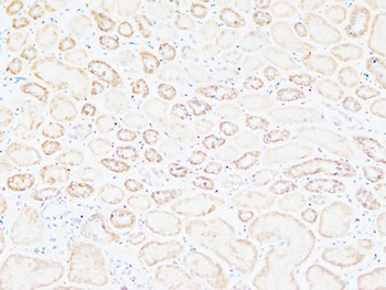 Tenascin-C antibody
