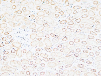 Tenascin-C antibody