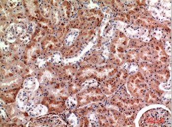 M-CSF antibody