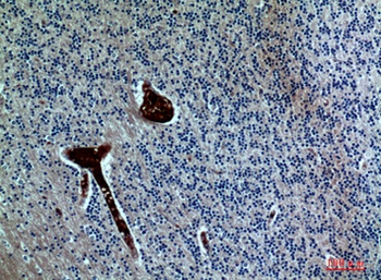 FGF-17 antibody