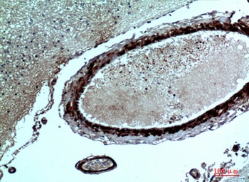 FGF-17 antibody