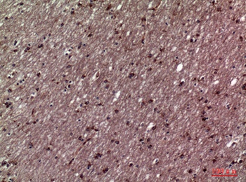 11β-HSD1 rabbit pAb
