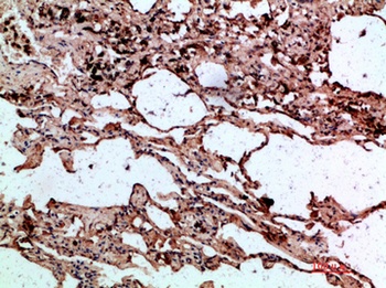 alpha 1 Antitrypsin antibody