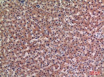 IGFBP1 antibody