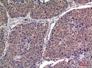 IGFBP1 antibody