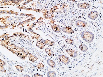 IL3R alpha antibody