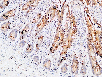 IL3R alpha antibody