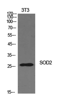 SOD-2 rabbit pAb Antibody