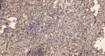 SOD-2 rabbit pAb Antibody
