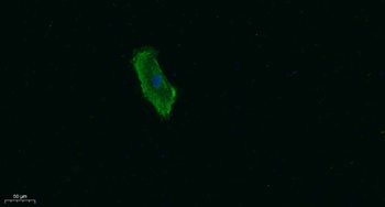 Talin-1 rabbit pAb Antibody