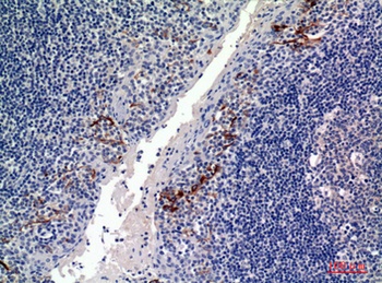 CD19 antibody