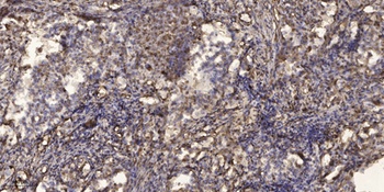 LIR-1 antibody