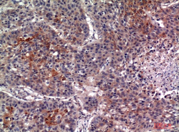 IL-13Rα2 rabbit pAb