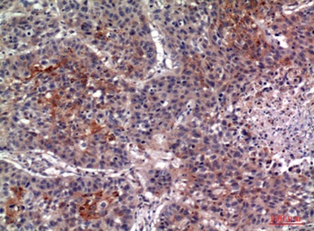 IL13R alpha 2 antibody