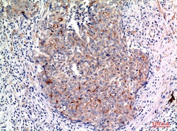 Mucin 1 antibody