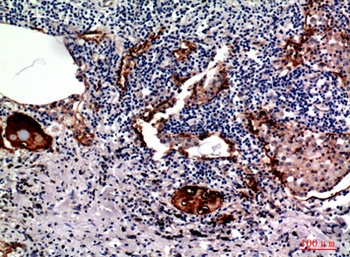 Mucin 1 antibody