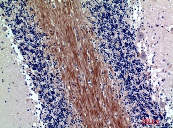 SIRP-α1/β1 rabbit pAb