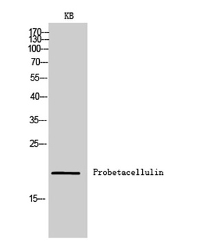 Probetacellulin antibody
