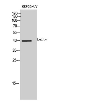 Lefty antibody