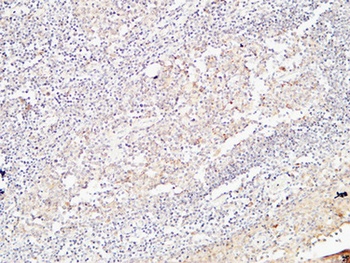 BMP-15 antibody