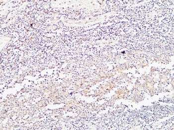 BMP-15 antibody