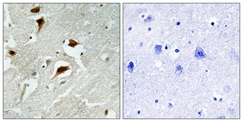 4E-BP1 (phospho-Thr69) antibody