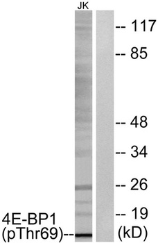 4E-BP1 (phospho-Thr69) antibody