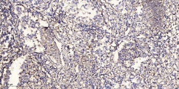 Tie-2 (phospho Tyr992) rabbit pAb