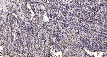 Tie-2 (phospho Tyr992) rabbit pAb