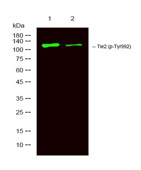 Tie-2 (phospho-Tyr992) antibody