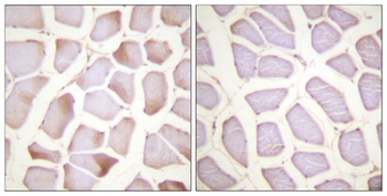 Troponin I-C (phospho-Ser22/S23) antibody