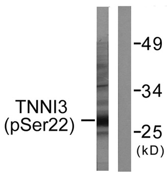 Troponin I-C (phospho-Ser22/S23) antibody