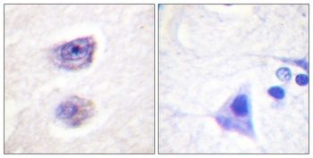 TH (phospho Ser8) rabbit pAb
