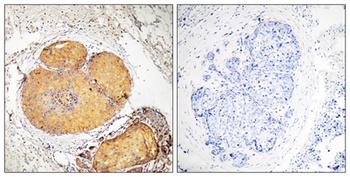 FADD (phospho Ser191) rabbit pAb