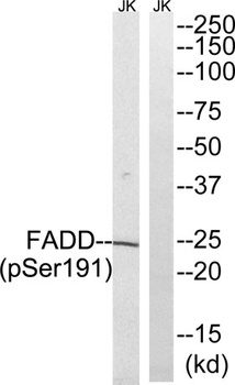 FADD (phospho Ser191) rabbit pAb