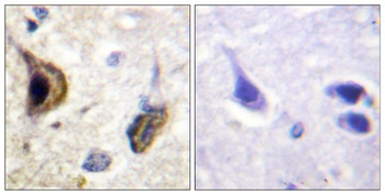 KIR5.1 (phospho Ser416) rabbit pAb