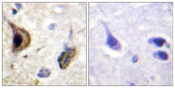 KIR5.1 (phospho-Ser416) antibody