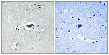 Ras-GRF1 (phospho Ser916) rabbit pAb