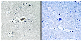 Ras-GRF1 (phospho-Ser916) antibody