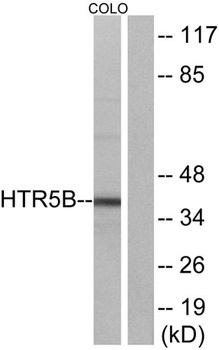 SR-5B rabbit pAb Antibody