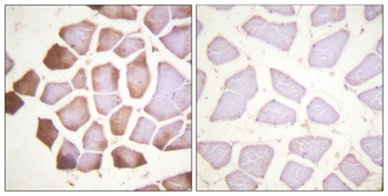 Troponin I-C rabbit pAb