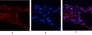 USP11 antibody