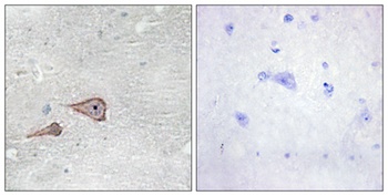 P-cadherin rabbit pAb