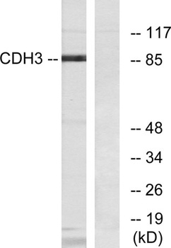 P-cadherin rabbit pAb