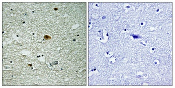 HDAC6 (phospho Ser22) rabbit pAb